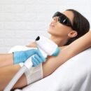 moteris kuriai atliekamas plauku salinimas